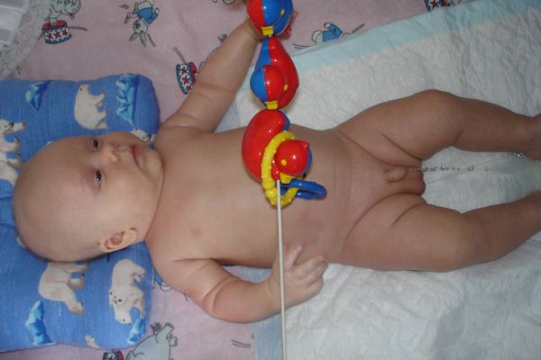 Половые органы новорожденного мальчика. Яички новорожденного мальчика.